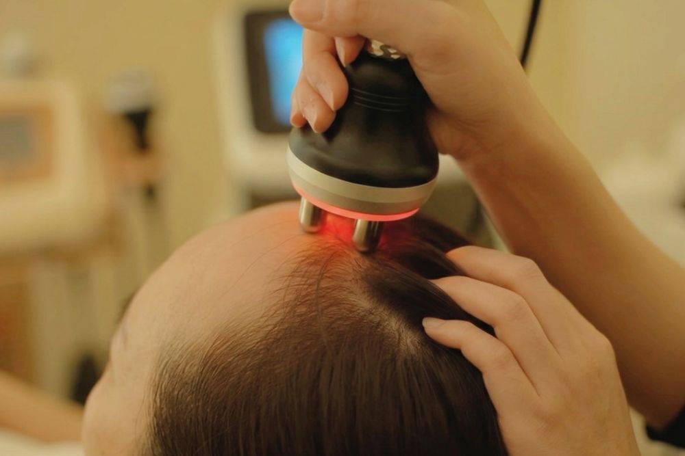 Scalp Renew Treatment